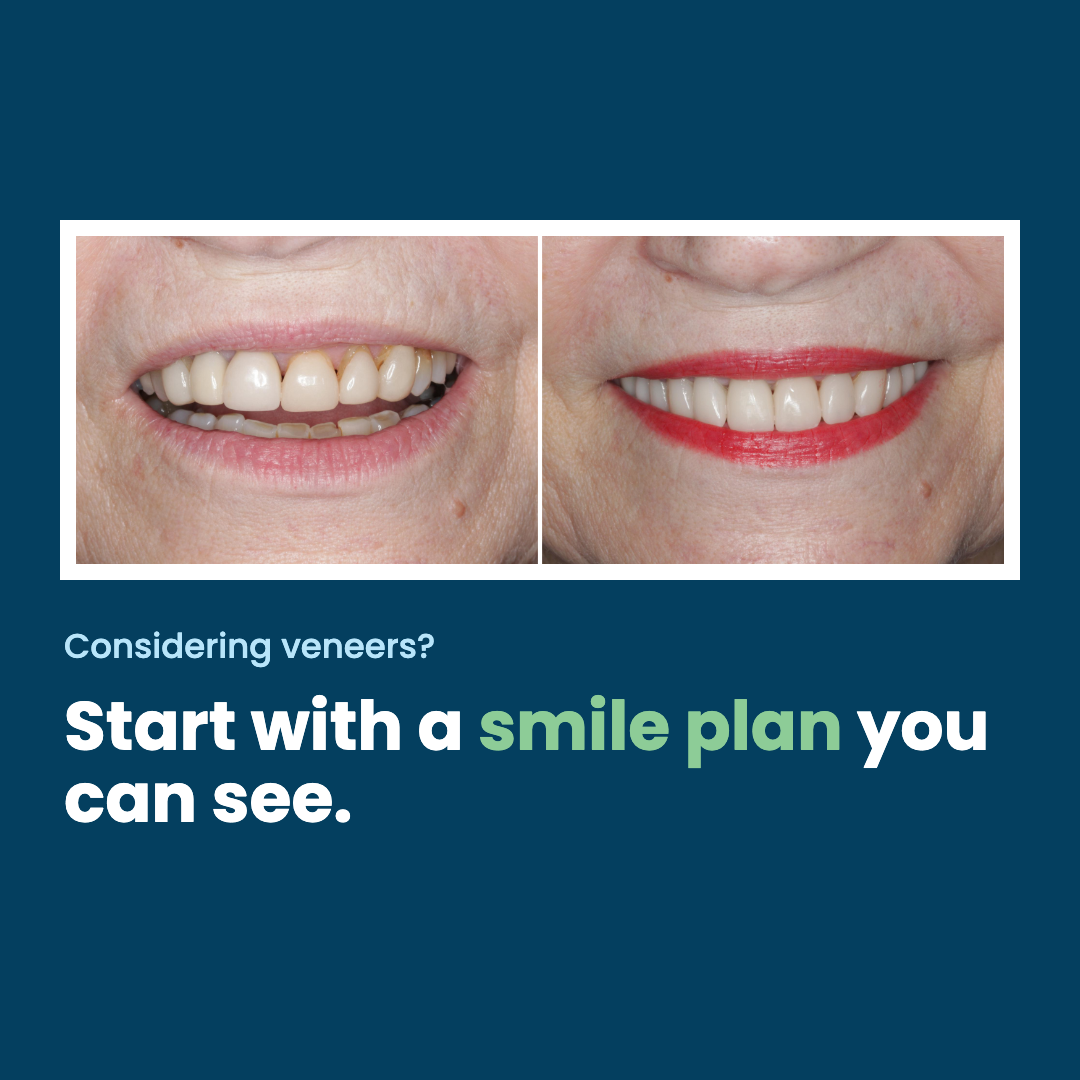 First finished Today's Dentistry image ad