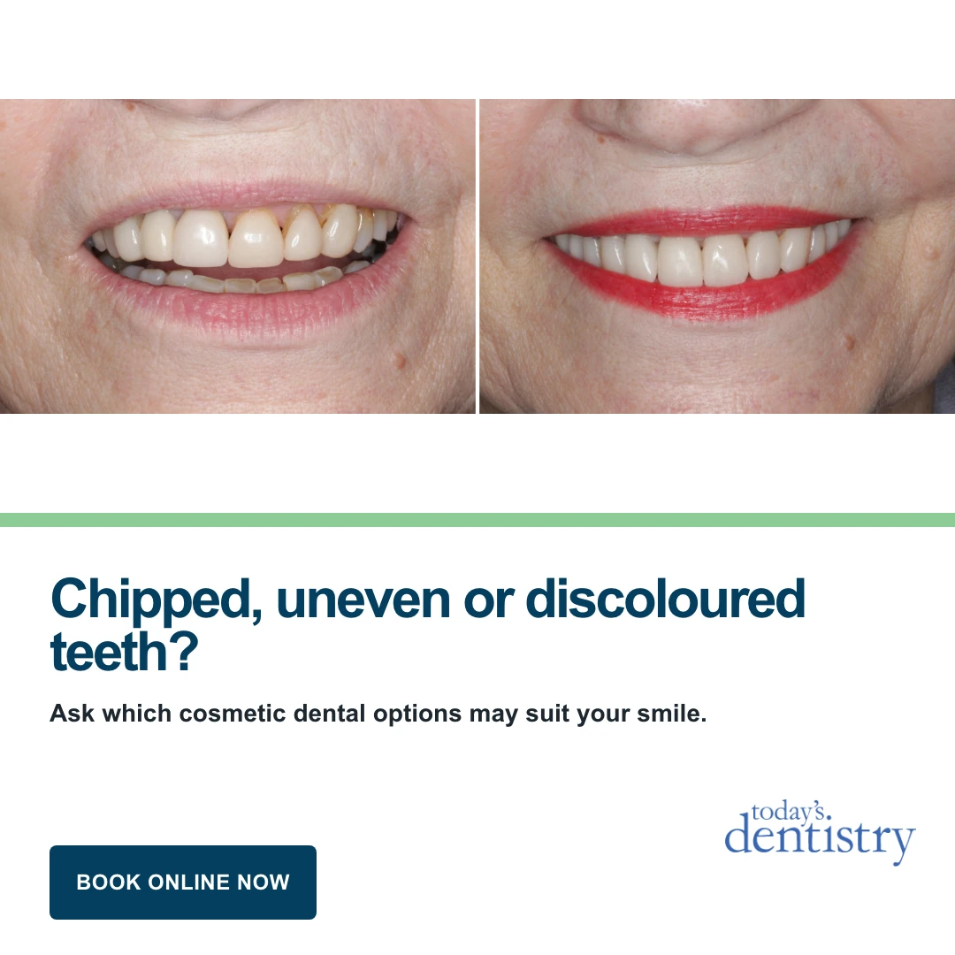 Chipped, uneven or discoloured teeth? ad creative